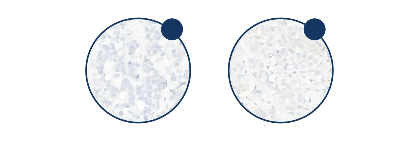 Microscopic images increasing from 10x to 40x, illustrating the magnification required to discriminate between IHC 0, 1+ and 2+.