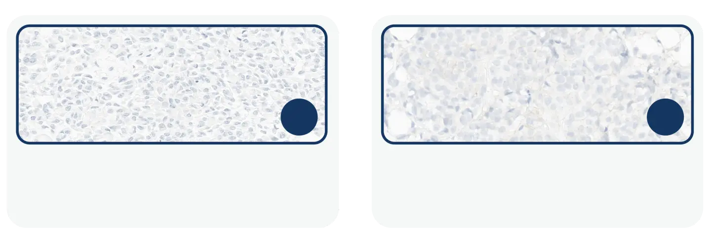 HER2 IHC