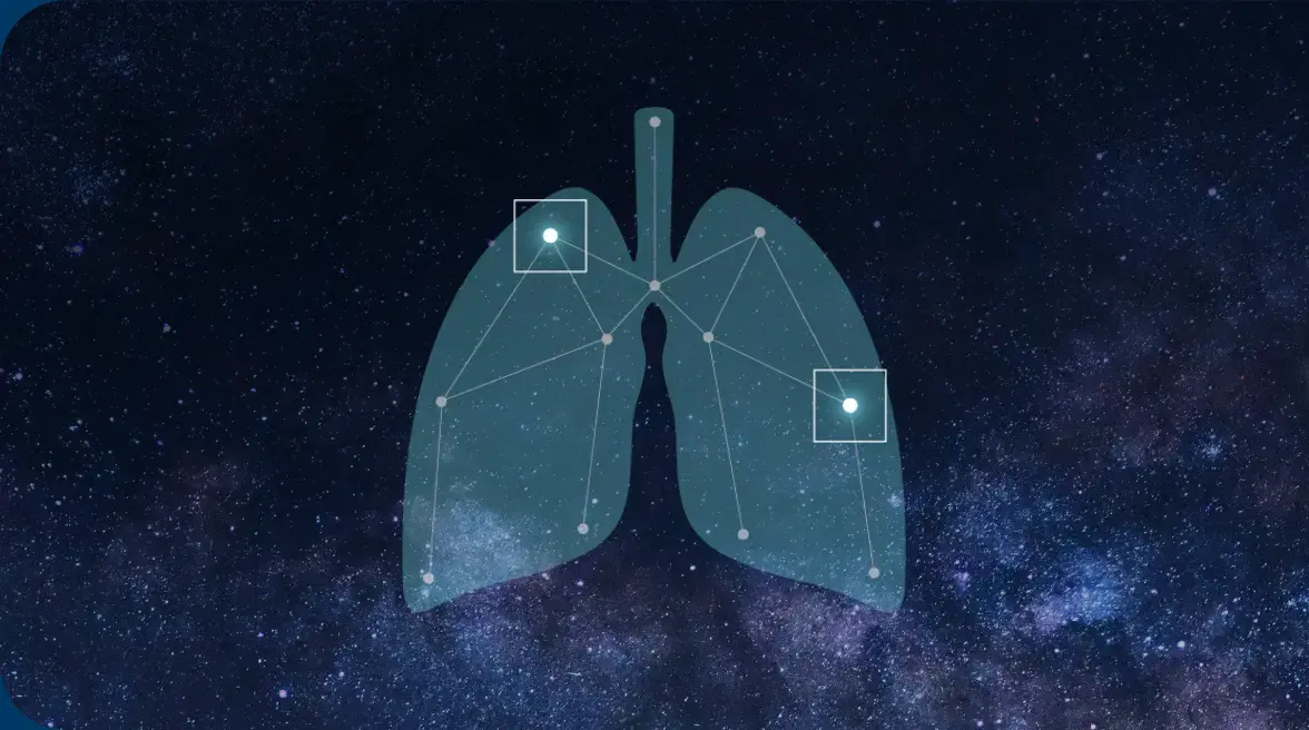 Lung cancer constellation