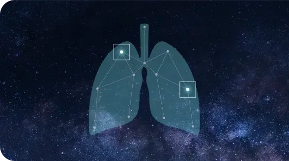 Lung cancer constellation