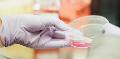 Zoomed in view of scientist's hand holding a Petri dish Zoomed in view of scientist's hand holding a Petri dish