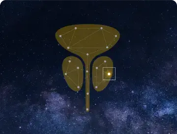PTEN Deficiency in Prostate Cancer Icon