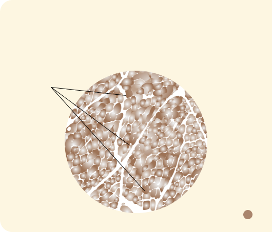 PTEN Proficient IHC Staining
