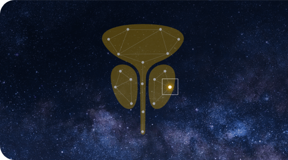 PTEN Deficiency in Prostate Cancer Icon