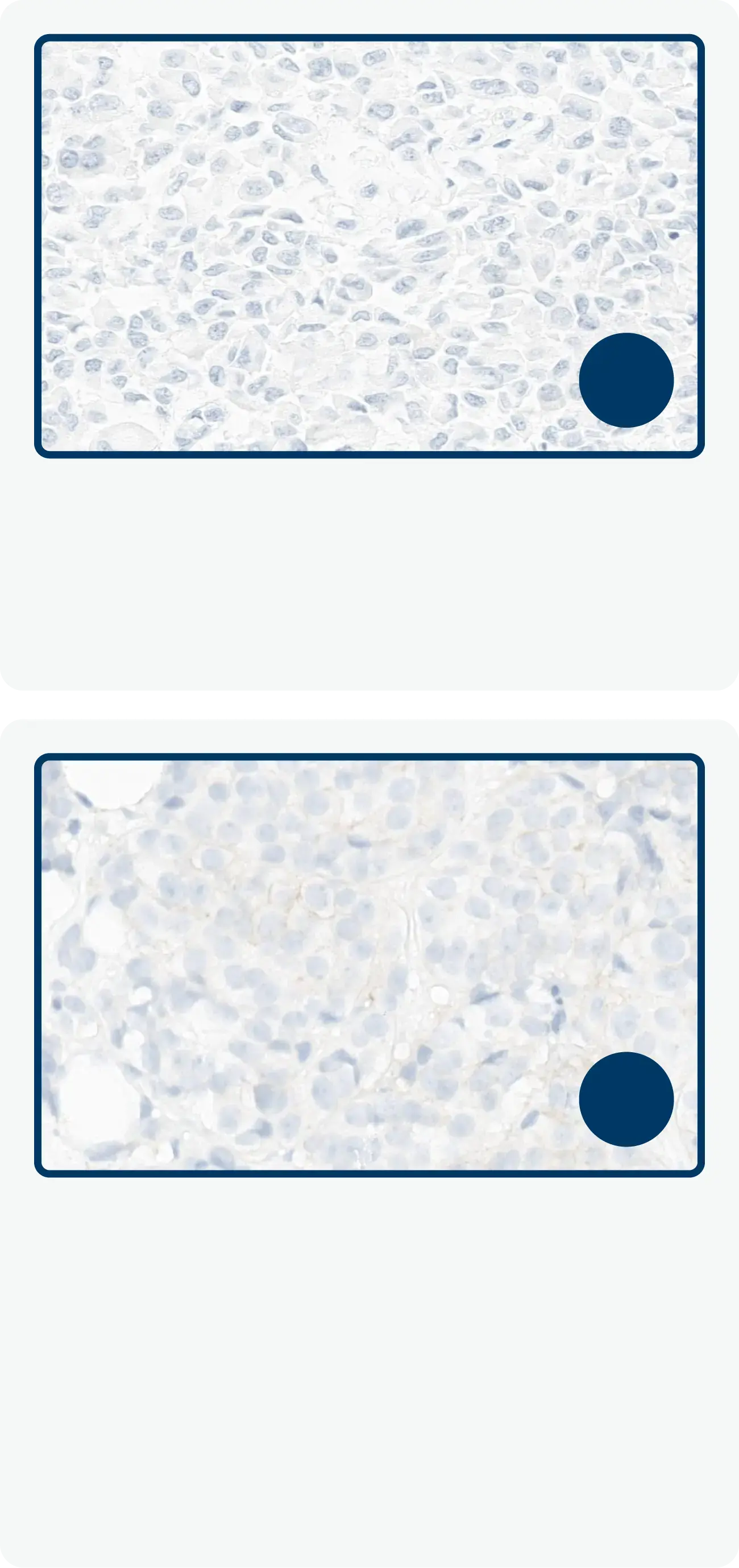 HER2 IHC